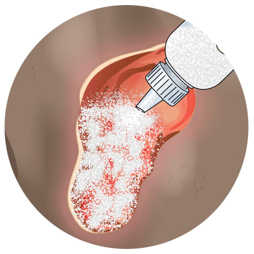 ReCruit™ Topical Extracellular Matrix Powder